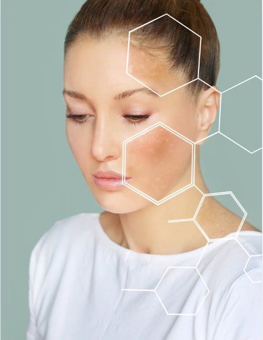 Late Winter Skin: How to Repair, Strengthen and Prepare Your Skin For Spring