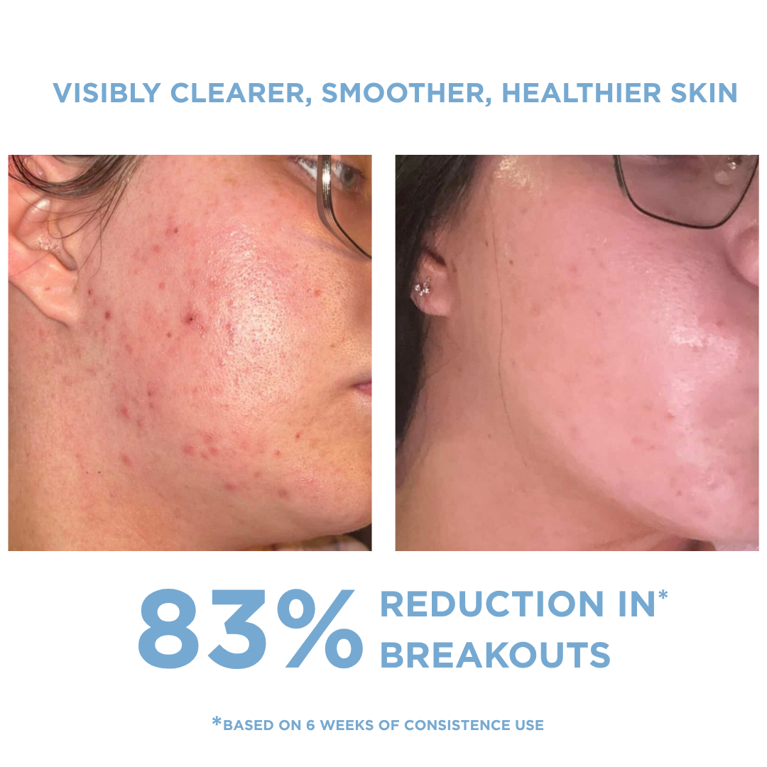 REFORM Skincare