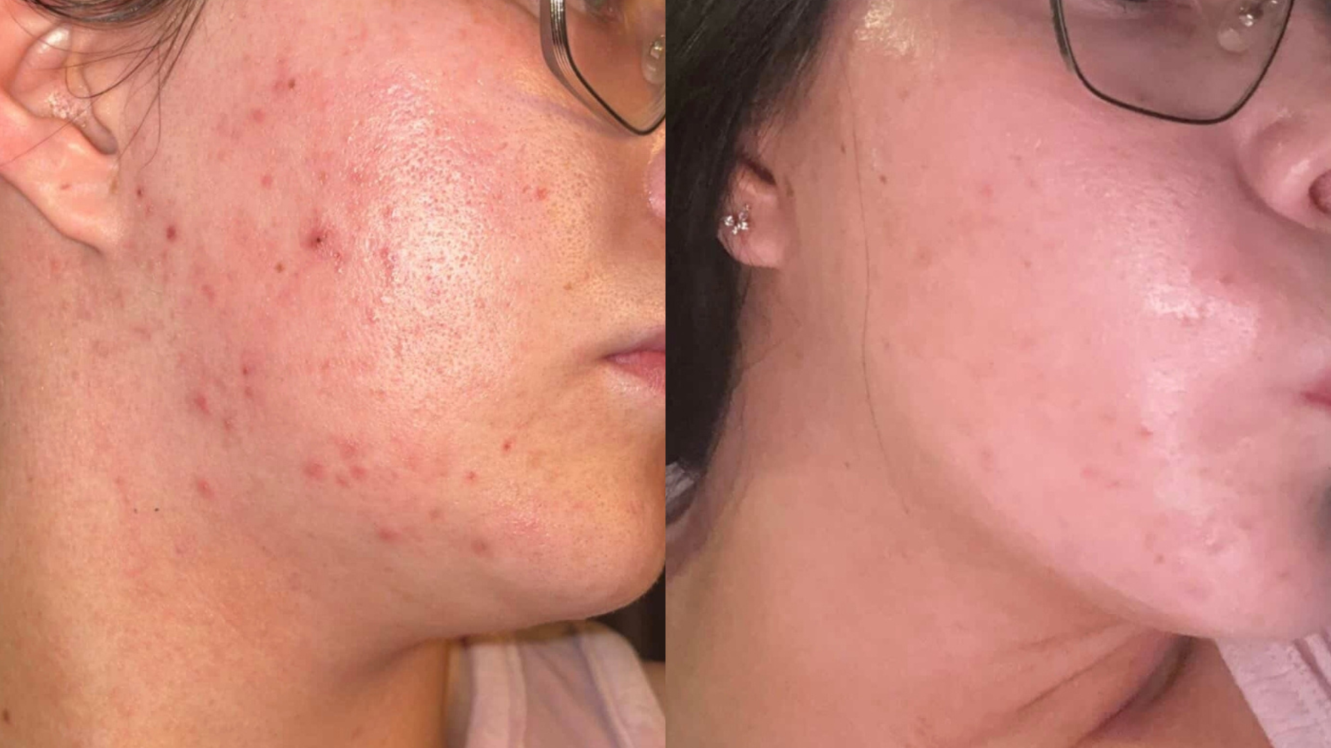REFORM Skincare