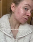 REFORM Skincare Anti-Blemish Kit video